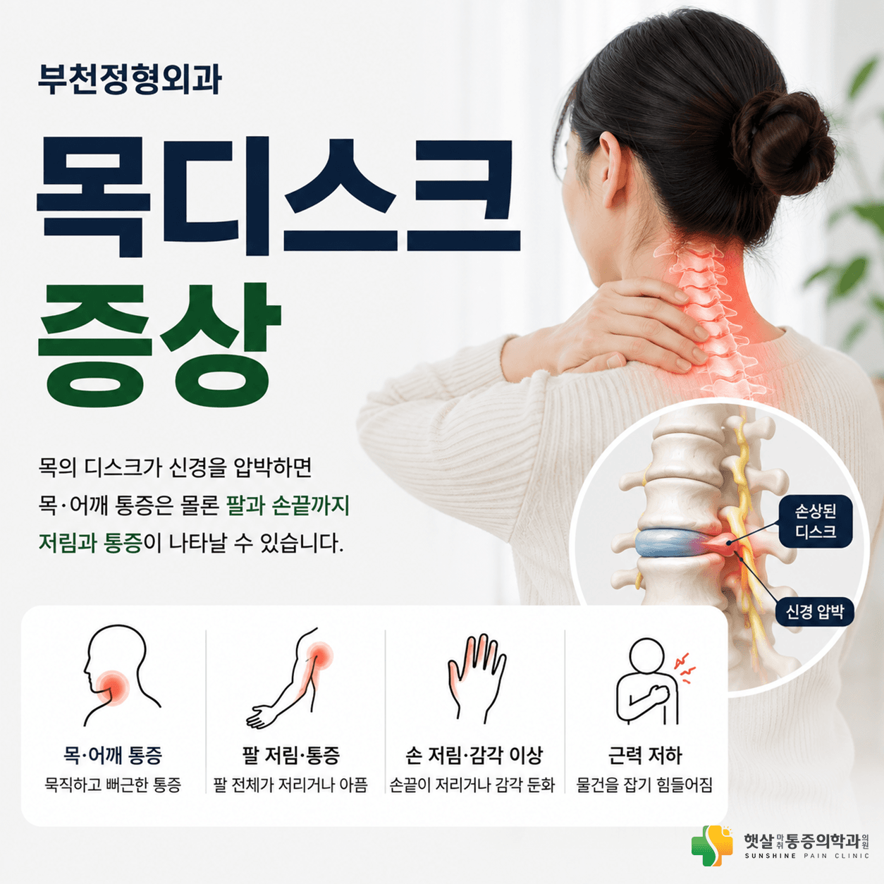 목디스크에서 목 어깨 팔 손으로 이어질 수 있는 증상 안내
