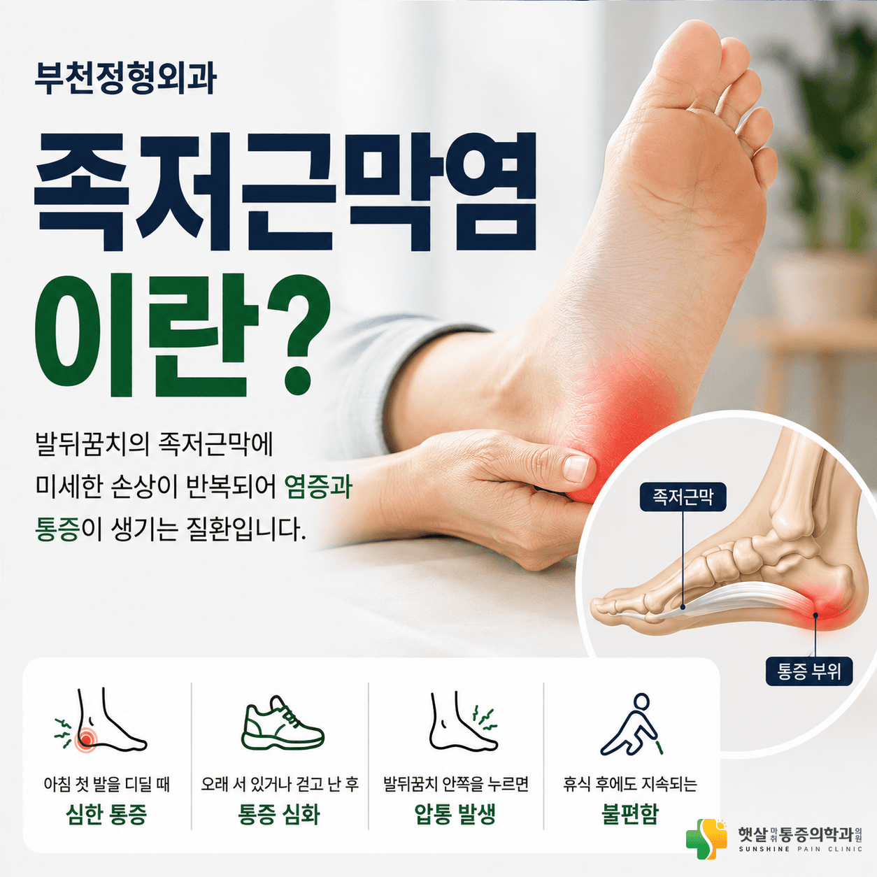 족저근막염에서 아침 첫걸음 발뒤꿈치 통증 안내