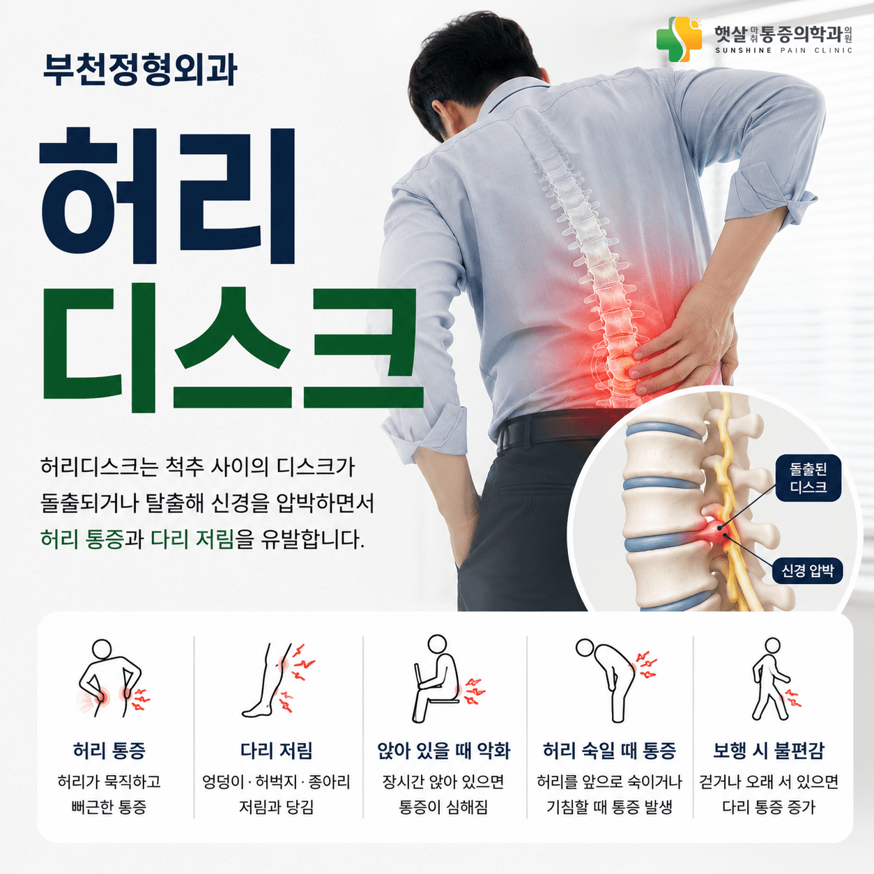 허리디스크에서 엉덩이와 다리로 이어질 수 있는 증상 안내