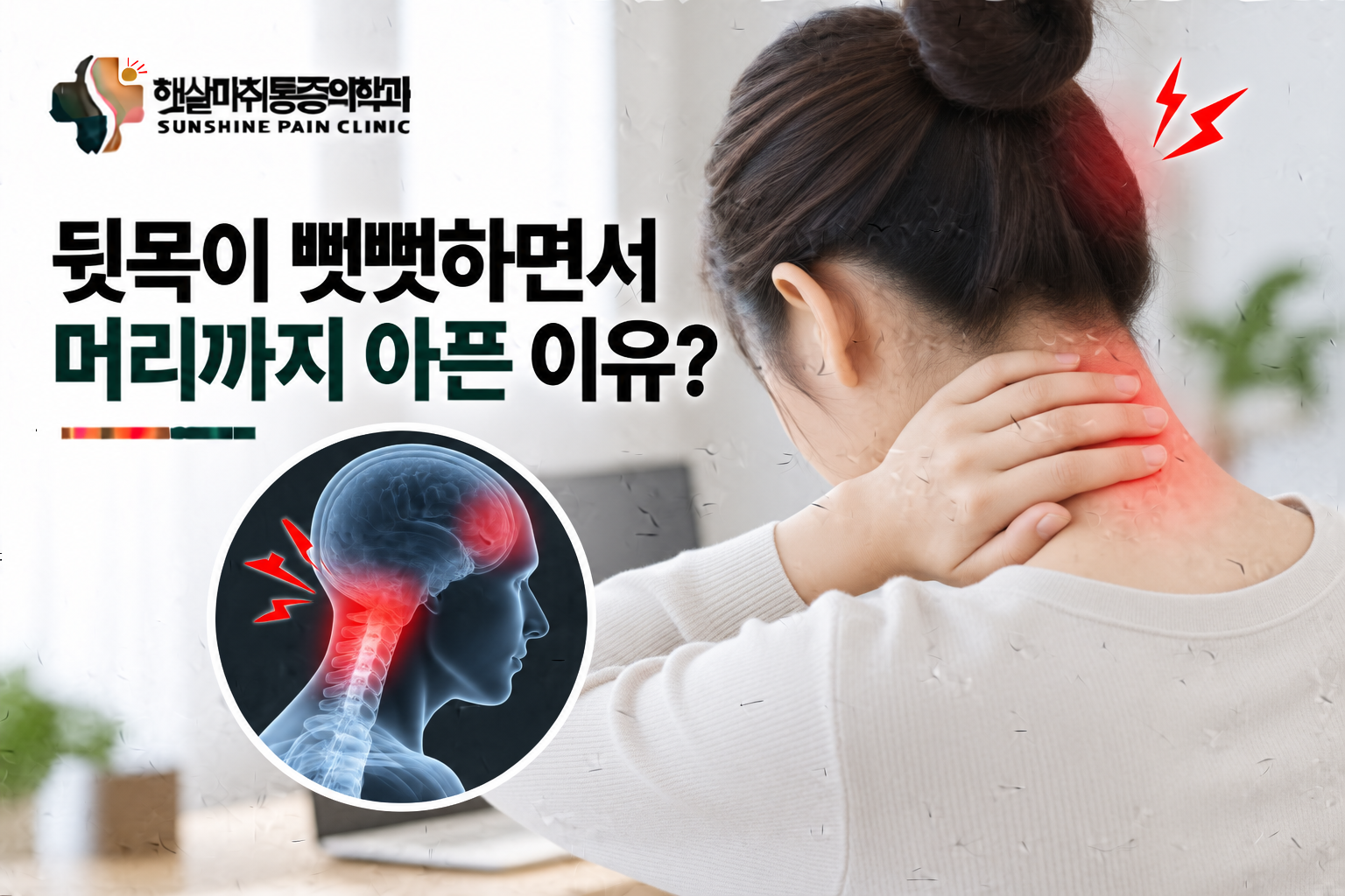 뒷목이 뻣뻣하면서 머리까지 아픈 이유